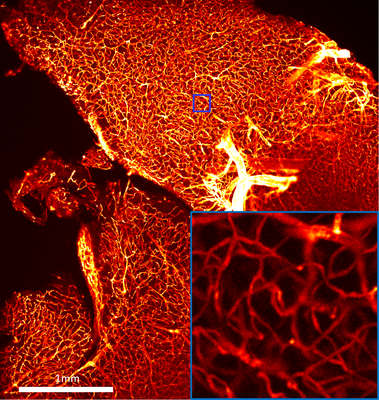 Section of a chemically cleared mouse brain, imaged with a light sheet microscope based on compressed sensing.   